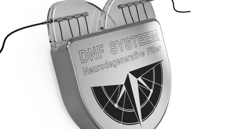 DNF-System